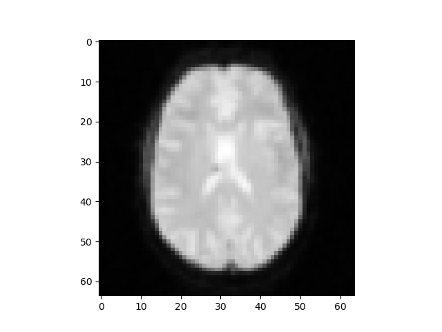 Part of the 3D images data visualization